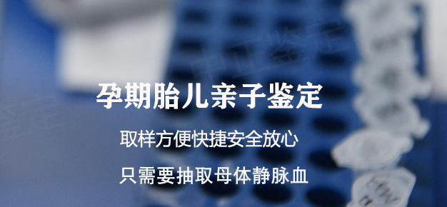 合肥如何做孕期亲子鉴定,